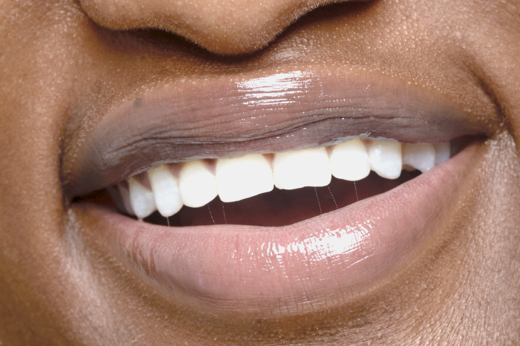 Extracao Odontologia